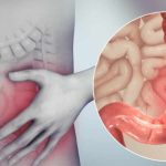 Tè per il colon irritabile, raccomandato da medici nutrizionisti