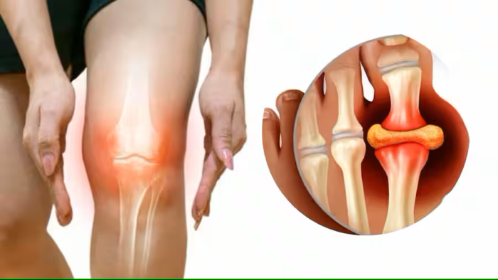 Top 5 succhi naturali che aiutano a eliminare le tossine dalle articolazioni