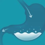Il rimedio per lo stomaco pigro con solo due ingredienti