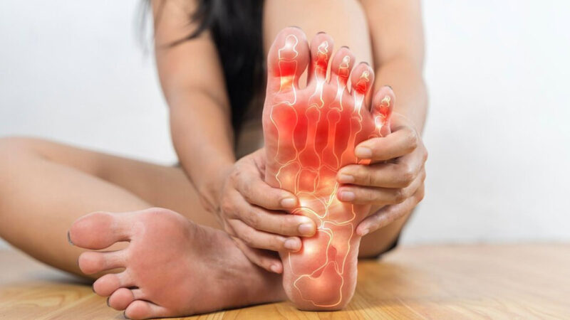 Riduzione dell’acido urico con rimedi naturali: i più efficaci consigliati dai medici