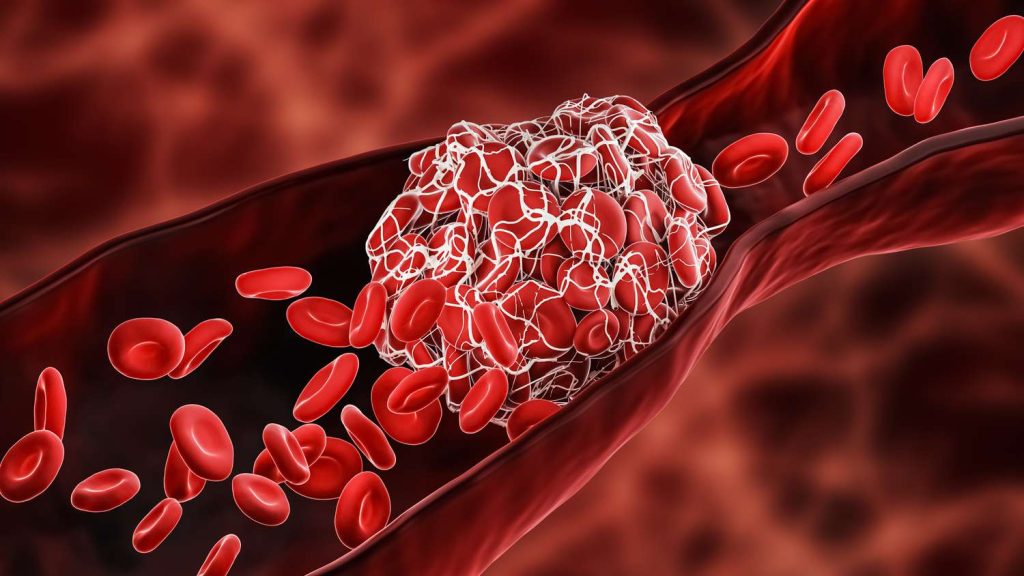 Alimenti che ngrossano il sangue che consumiamo quotidianamente senza rendercene conto