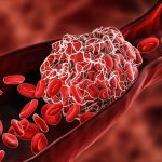 Alimenti che ngrossano il sangue che consumiamo quotidianamente senza rendercene conto