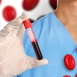 Alimenti che riempiono rapidamente il sangue di tossine