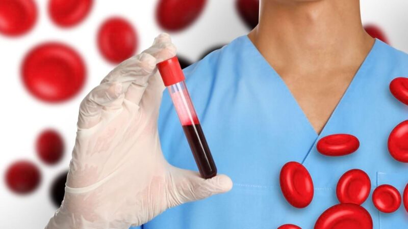 Alimenti che riempiono rapidamente il sangue di tossine