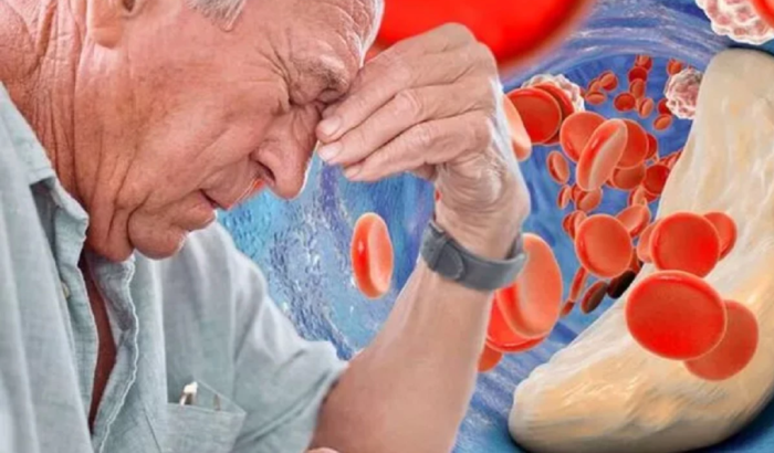 Il succo che purifica il sangue da colesterolo e tossine. Si beve tra i pasti per disostruire le arterie