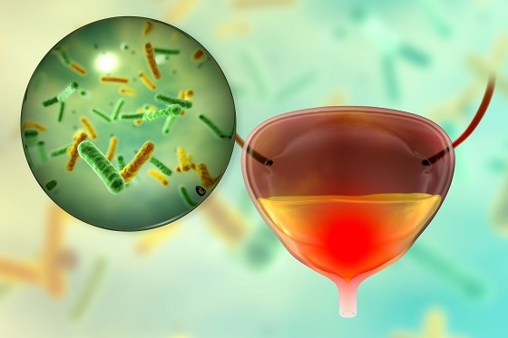 Cosa puoi prendere per le infezioni urinarie lievi, senza antibiotici
