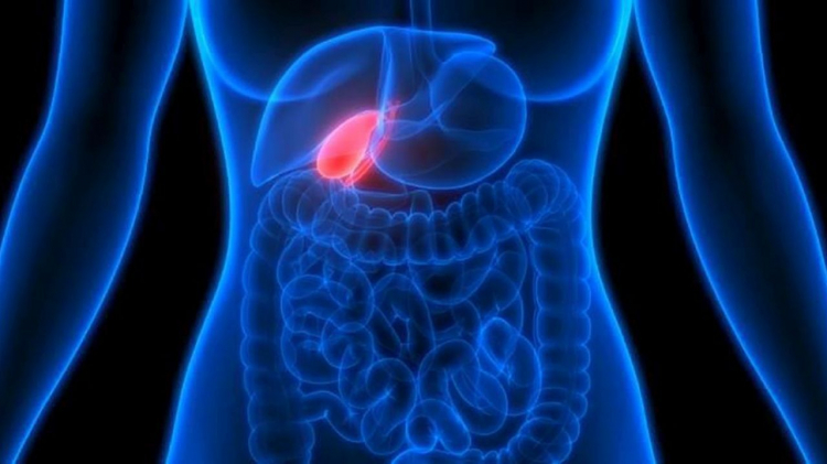 I rimedi naturali più efficaci per la bile pigra: i medici nutrizionisti dicono che dissolvono i calcoli biliari