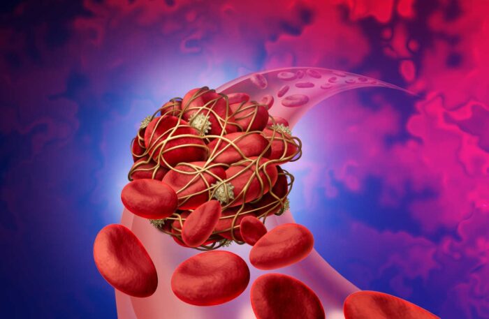 I migliori frutti per prevenire i coaguli di sangue