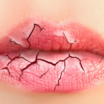 10 migliori rimedi naturali per labbra secche e screpolate