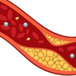 Rimedio naturale molto efficace per abbassare il colesterolo: ricetta e modalità di assunzione + consigli di un medico