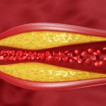 5 super-alimenti che riducono il colesterolo e dissolvono i grassi nel sangue