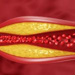 Il tè che riduce il colesterolo senza farmaci: ricetta testata clinicamente (ricetta e controindicazioni)