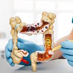 5 bevande naturali ed efficaci per la pulizia del colon