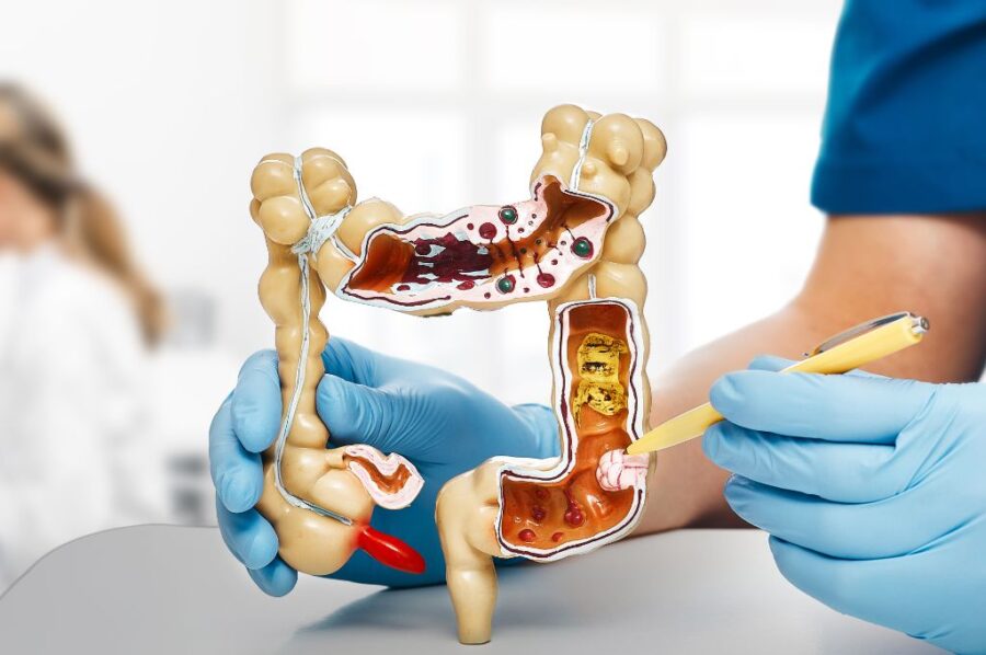 5 bevande naturali ed efficaci per la pulizia del colon