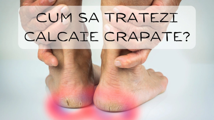 7 modi per liberarsi delle crepe sui talloni (ricette)