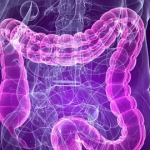 PULIZIA DEL COLON nel modo più NATURALE ed EFFICACE