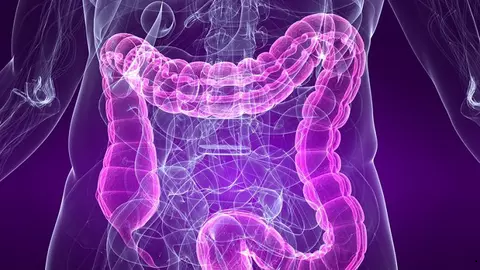 PULIZIA DEL COLON nel modo più NATURALE ed EFFICACE