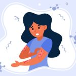 Psoriasi e infiammazione: Strategie per una vita più serena