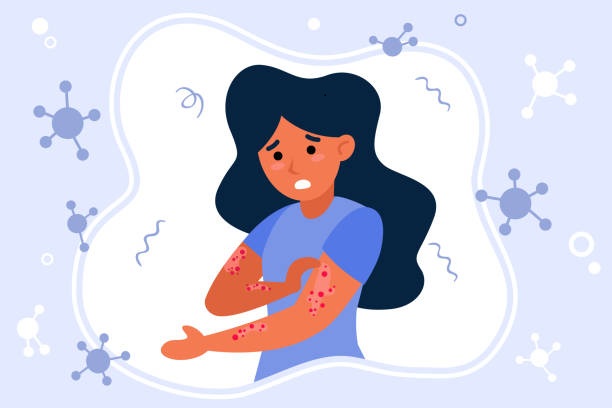 Psoriasi e infiammazione: Strategie per una vita più serena