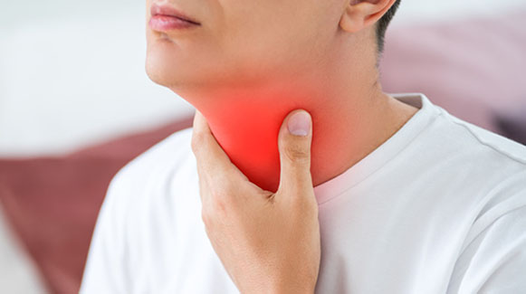 I migliori 8 rimedi naturali per il mal di gola