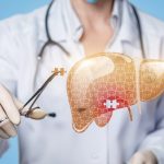 STRESS E FEGATO: la relazione tra di essi e soluzioni naturali supportate dalla medicina tradizionale cinese