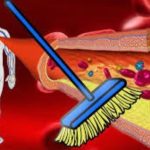 I segni nascosti delle arterie ostruite e le soluzioni naturali per la cura