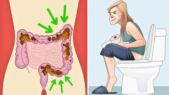 Come liberarsi dalla stitichezza in modo naturale: Rimedi con effetto garantito