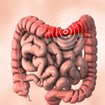 Problemi con il colon irritabile? Non consumare questo frutto!