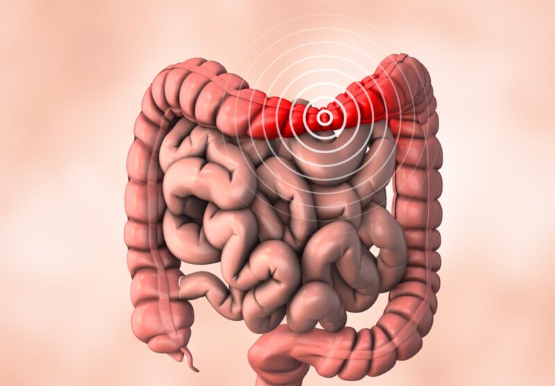 Problemi con il colon irritabile? Non consumare questo frutto!