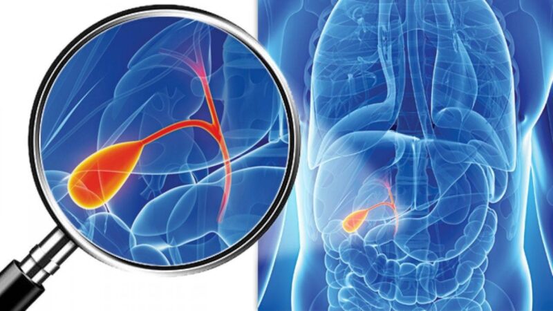 Pianta con azione rapida nelle crisi biliari: come si utilizza