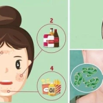 La pianta che elimina le tossine dal corpo senza effetti collaterali