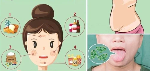 La pianta che elimina le tossine dal corpo senza effetti collaterali
