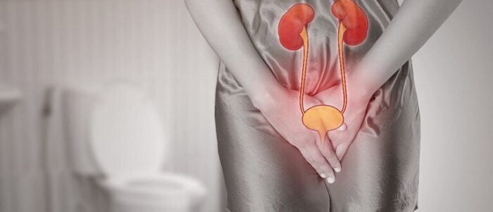 Trattamento naturale per infezioni urinarie: Ricette efficaci e consigli degli esperti