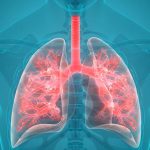 Rimedi naturali a portata di mano per la cura e il mantenimento della salute dei polmoni