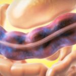 Ricetta monastica per la pulizia intestinale con effetti delicati