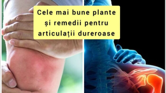 Le migliori piante e rimedi per le articolazioni