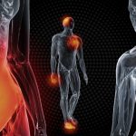 Queste spezie e erbe sono molto efficaci nella riduzione dell’infiammazione