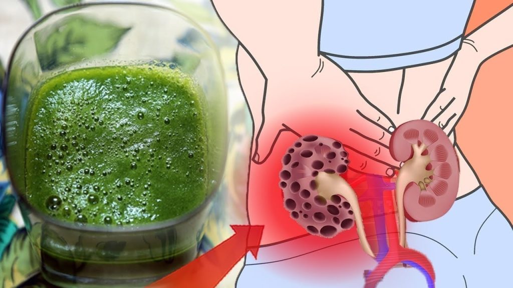 I benefici del tè e del succo di prezzemolo per la salute dei reni: proprietà, benefici e modalità di preparazione