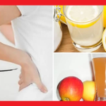 Rimedi naturali per i calcoli renali. Come prevenire e trattare la litiasi renale
