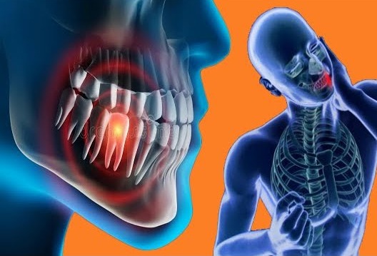 I rimedi naturali più efficaci per il dolore ai denti e alle gengive: cosa puoi provare a casa fino a quando non arrivi dal medico