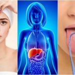 17 segni che il tuo fegato è sovraccarico e ha bisogno di disintossicazione: soluzioni naturali