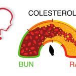 Superfood che riduce rapid colesterolul