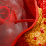 Il colesterolo scompare come per magia: 7 rimedi naturali scientificamente provati che purificano i vasi sanguigni e ripristinano l’equilibrio del cuore
