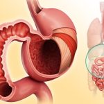 Come fare correttamente una cura di piante per la digestione senza effetti avversi