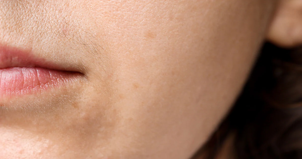 Il testosterone nelle donne: cos’è e come influisce sulla salute