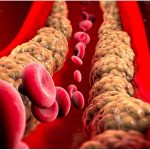 8 modi per ridurre i trigliceridi e il colesterolo