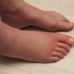 Acqua in cui bollire prezzemolo e limone: un vecchio trucco per le gambe gonfie (indicazioni passo dopo passo)