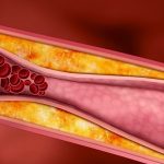 10 alimenti che prevengono l’indurimento dei vasi sanguigni