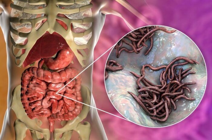 Alimenti con effetto antiparassitario: liberati naturalmente dai vermi intestinali